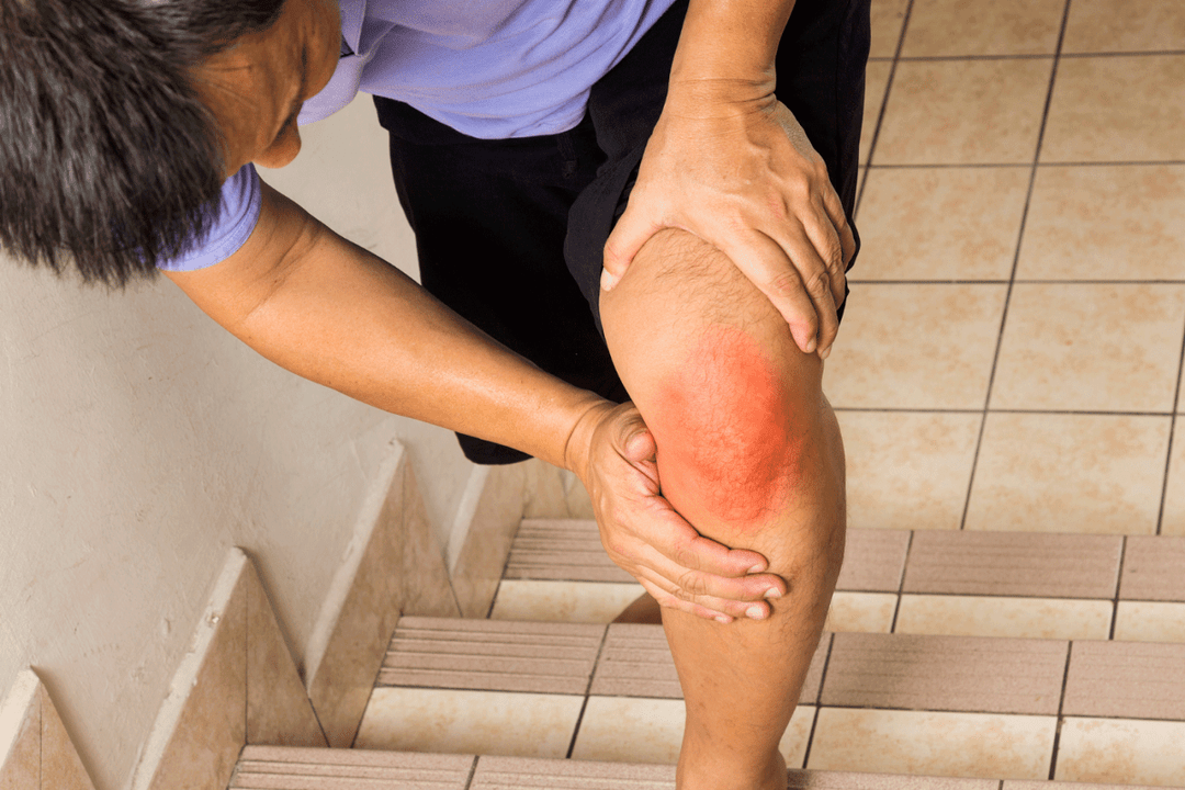 Joint pain due to osteoarthritis