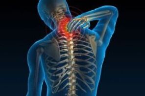 cervical osteochondrosis leads to pain in the neck
