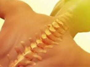 Osteochondrosis - spine disease