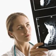 The diagnosis of osteochondrosis is specified using an X beam examination